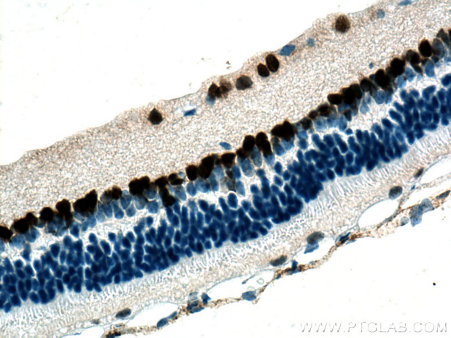 PAX6 Antibody in Immunohistochemistry (Paraffin) (IHC (P))