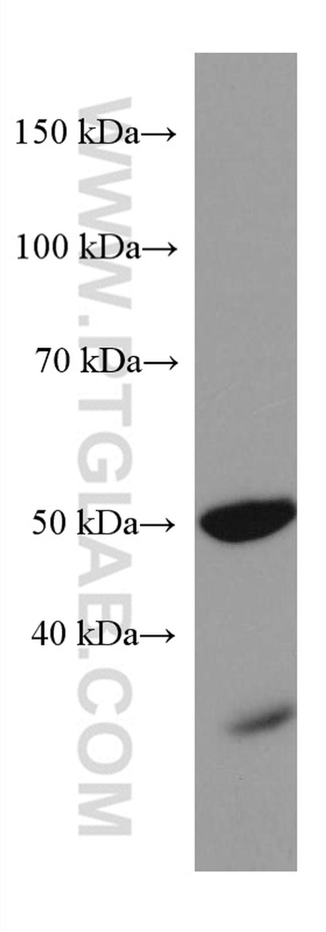 PAX6 Antibody in Western Blot (WB)