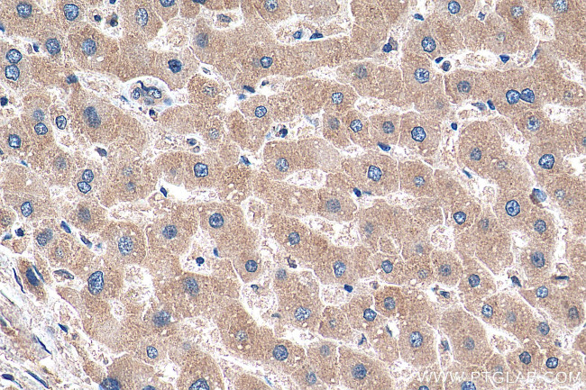 SLC2A9 Antibody in Immunohistochemistry (Paraffin) (IHC (P))