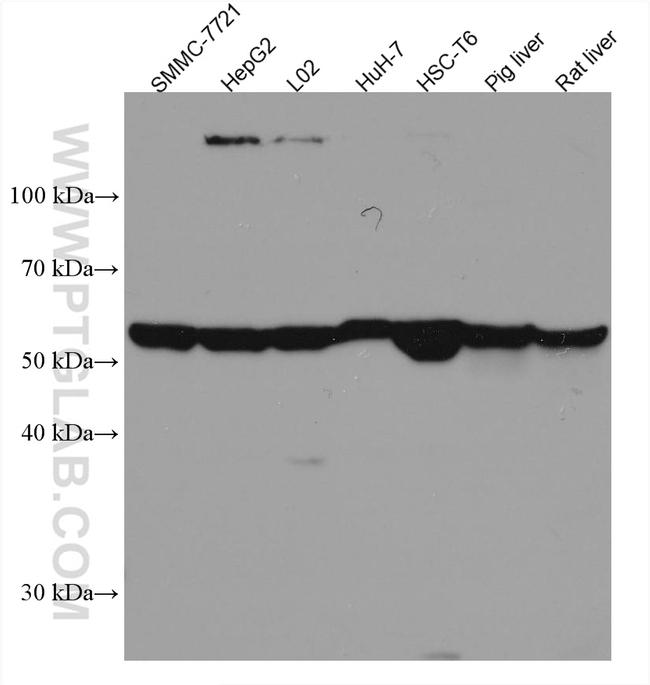 SLC2A9 Antibody in Western Blot (WB)