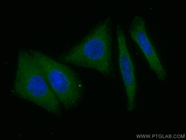 GPT/ALT1 Antibody in Immunocytochemistry (ICC/IF)