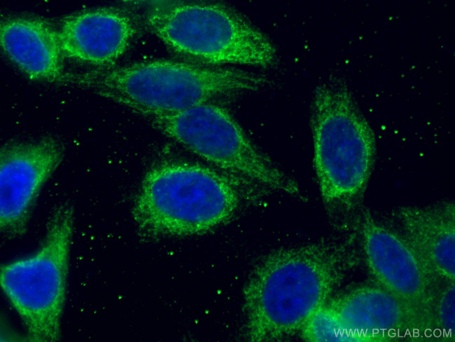 Tim23 Antibody in Immunocytochemistry (ICC/IF)