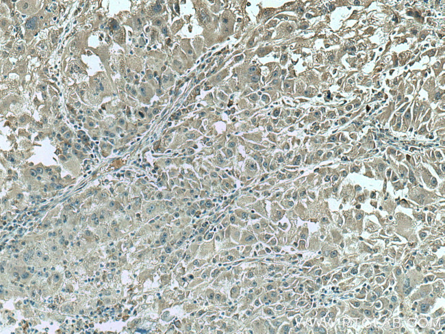 CCT8 Antibody in Immunohistochemistry (Paraffin) (IHC (P))