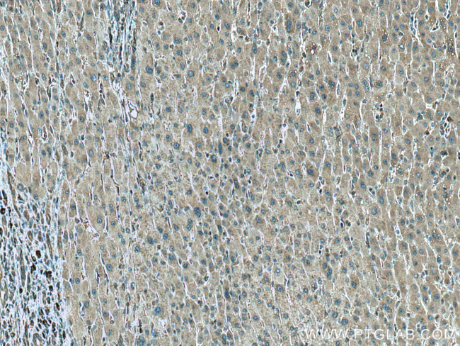 CCT8 Antibody in Immunohistochemistry (Paraffin) (IHC (P))