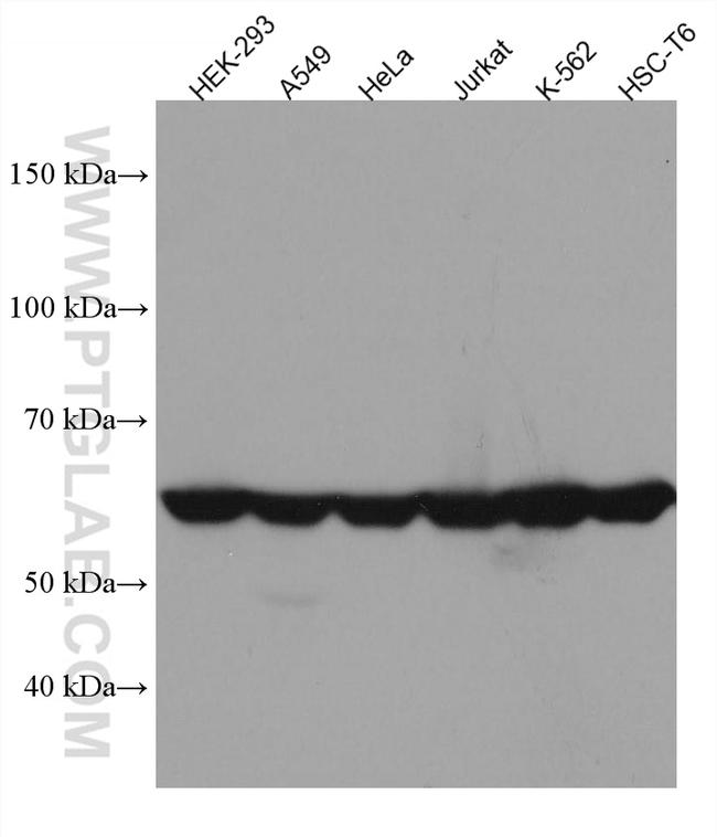 CCT8 Antibody in Western Blot (WB)