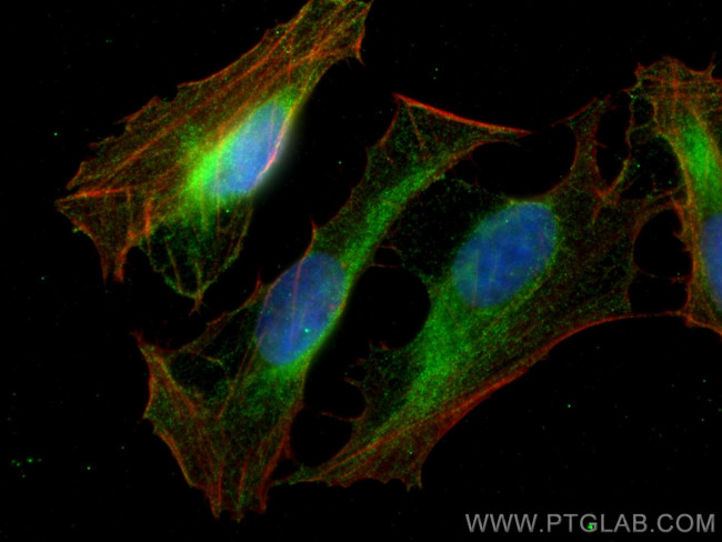 CCT7 Antibody in Immunocytochemistry (ICC/IF)