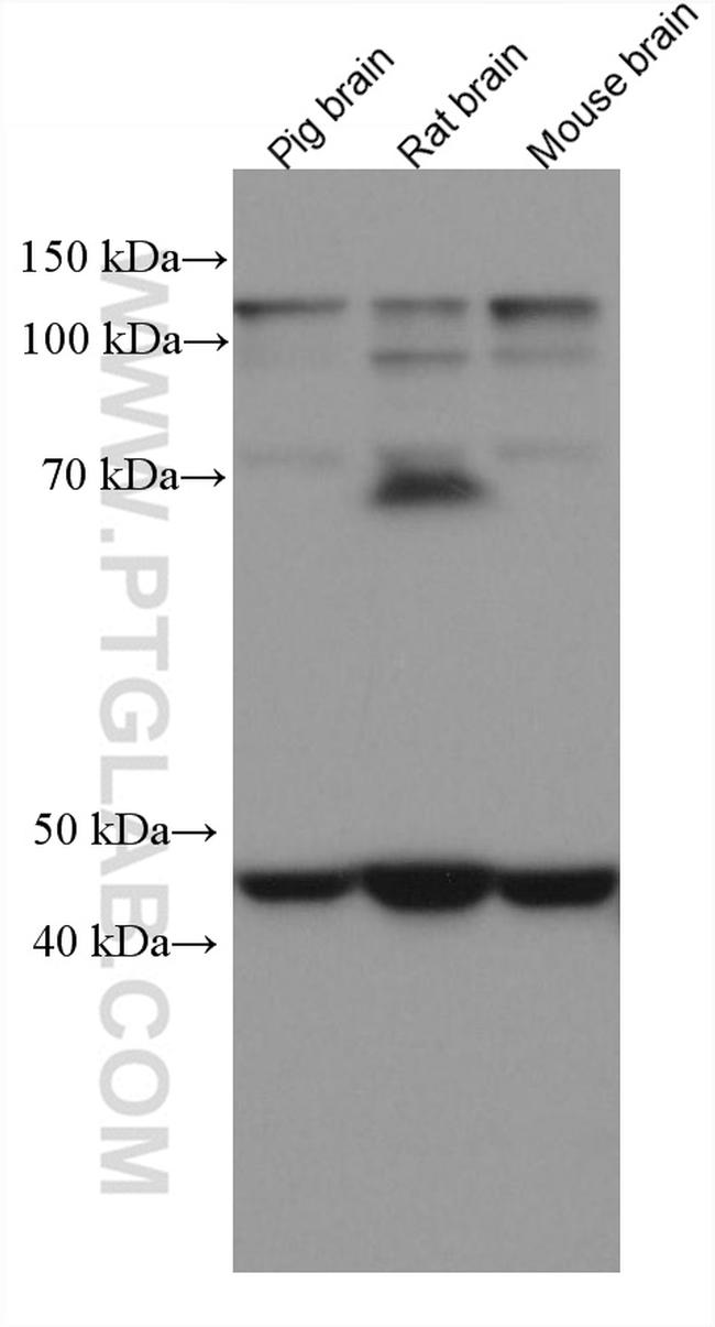 UQCRC2 Antibody in Western Blot (WB)