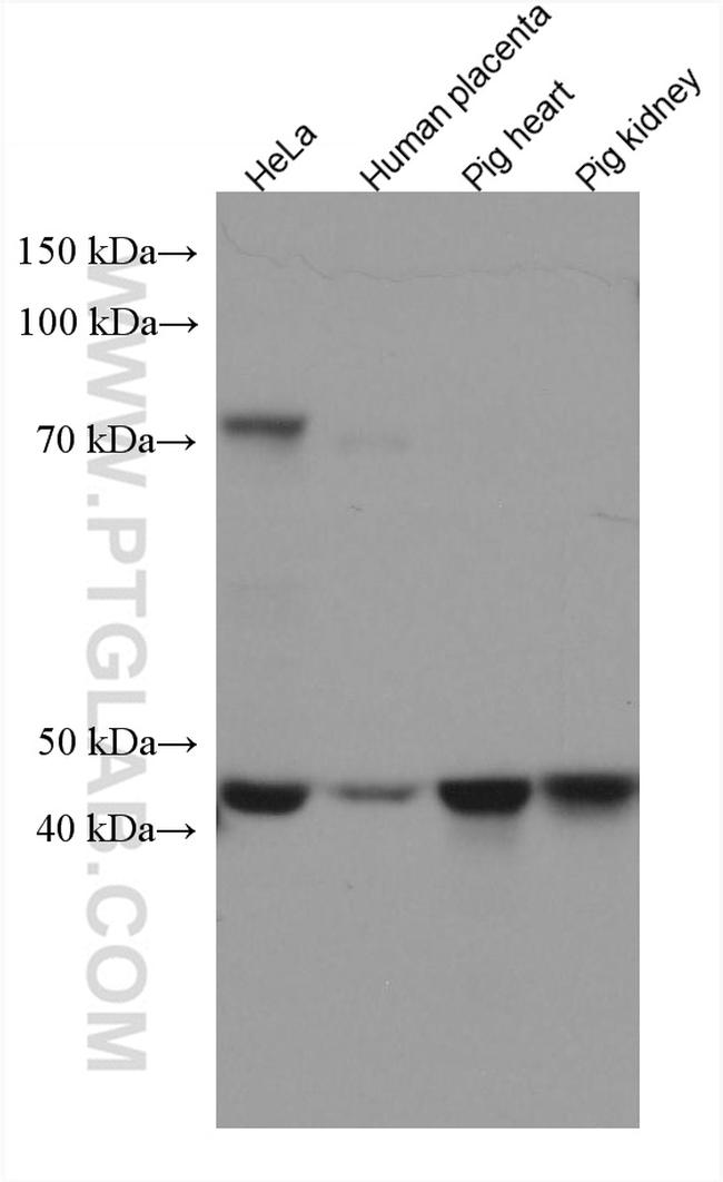 UQCRC2 Antibody in Western Blot (WB)