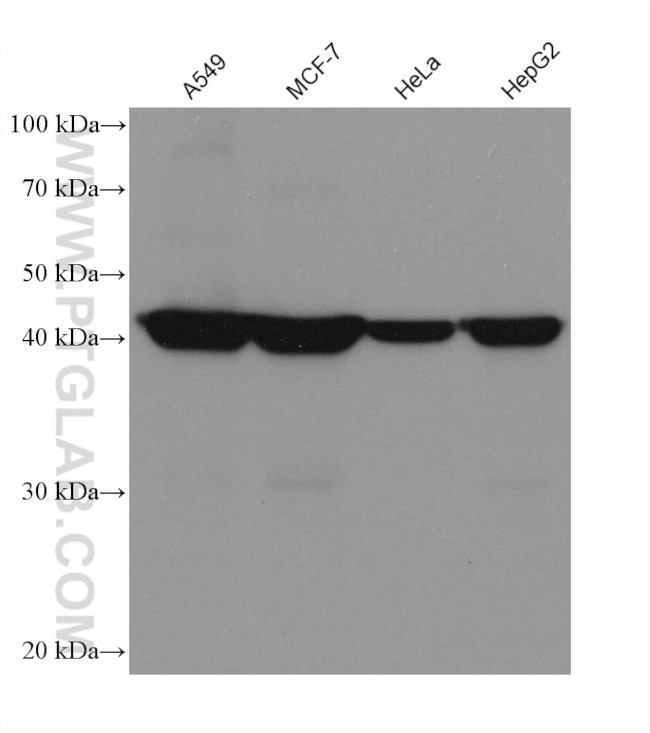 Septin 9 Antibody in Western Blot (WB)