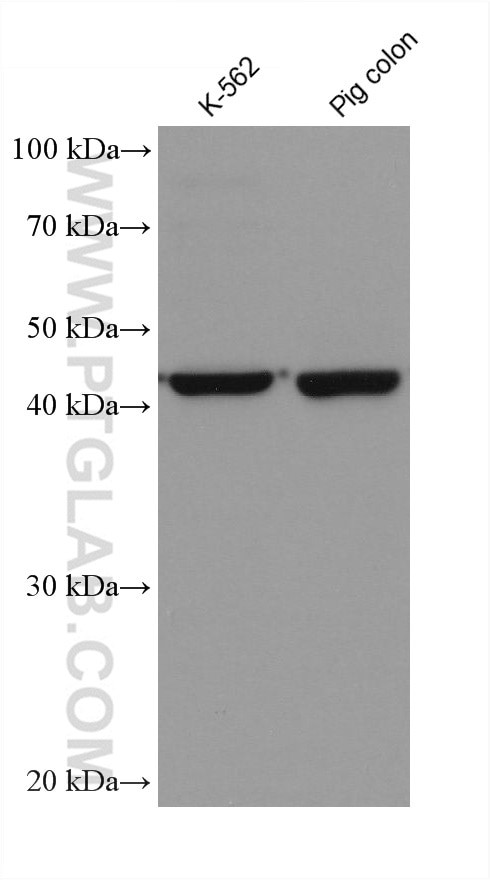 Septin 9 Antibody in Western Blot (WB)