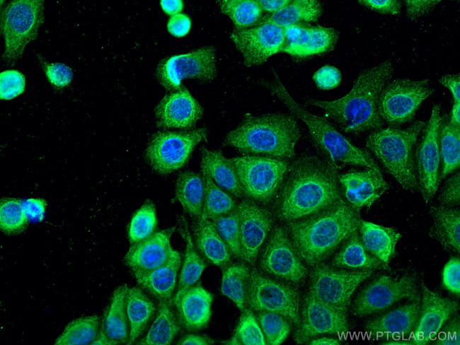 IPO4 Antibody in Immunocytochemistry (ICC/IF)