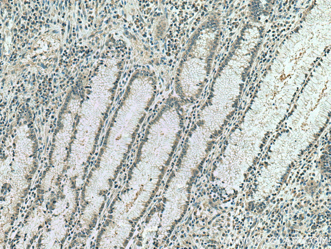 IPO4 Antibody in Immunohistochemistry (Paraffin) (IHC (P))