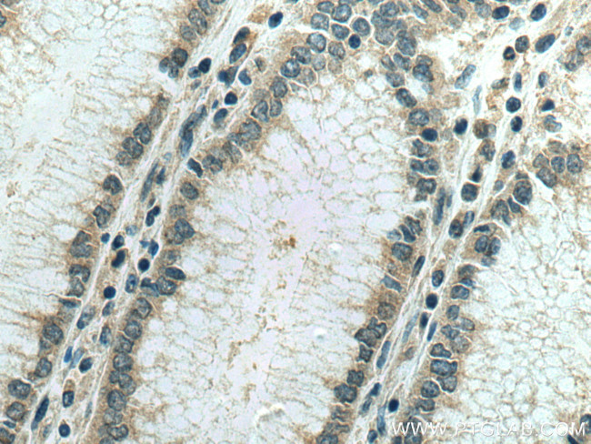 IPO4 Antibody in Immunohistochemistry (Paraffin) (IHC (P))