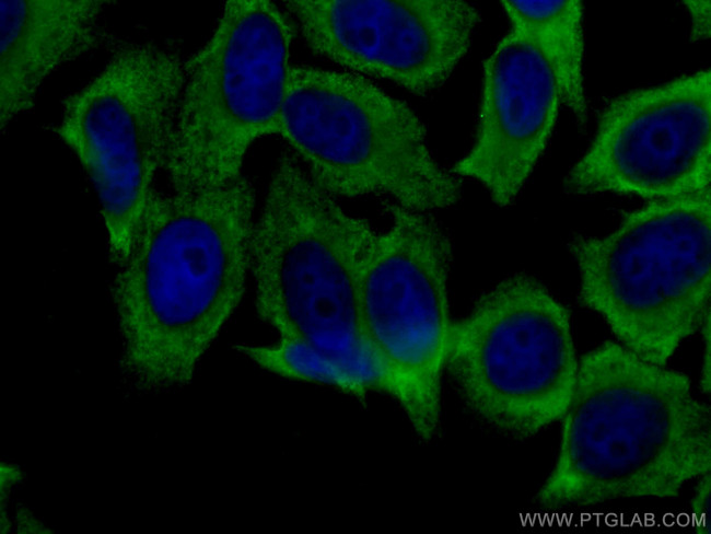 EEF2 Antibody in Immunocytochemistry (ICC/IF)