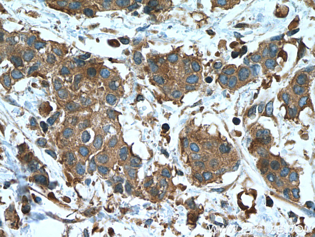 EEF2 Antibody in Immunohistochemistry (Paraffin) (IHC (P))