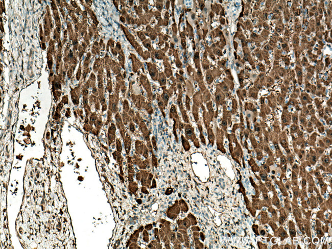 HPD Antibody in Immunohistochemistry (Paraffin) (IHC (P))