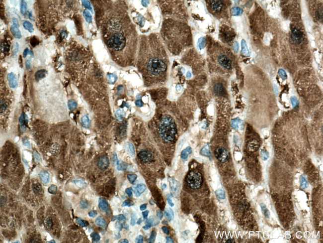 HPD Antibody in Immunohistochemistry (Paraffin) (IHC (P))