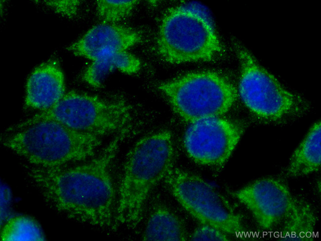 RIG-1/DDX58 Antibody in Immunocytochemistry (ICC/IF)