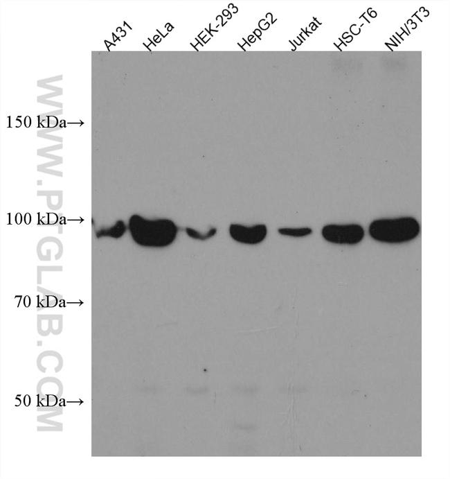 RIG-1/DDX58 Antibody in Western Blot (WB)