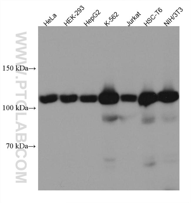 USP15 Antibody in Western Blot (WB)