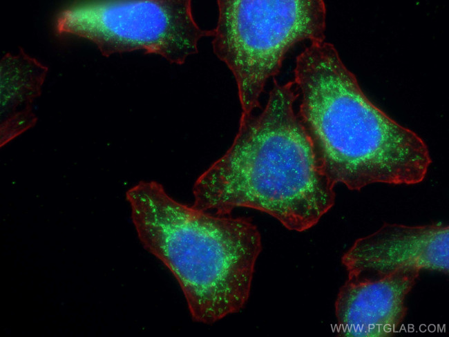 Phospho-GSK3B (Ser9) Antibody in Immunocytochemistry (ICC/IF)