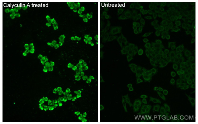 Phospho-GSK3B (Ser9) Antibody in Immunocytochemistry (ICC/IF)