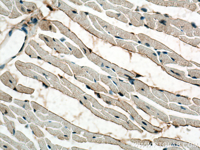 MTMR14 Antibody in Immunohistochemistry (Paraffin) (IHC (P))