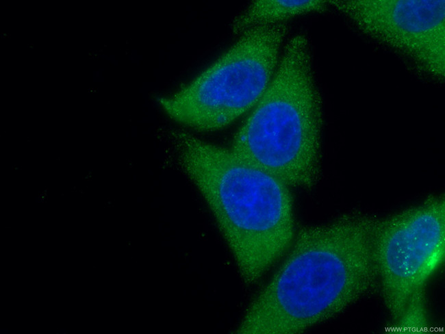 STAT4 Antibody in Immunocytochemistry (ICC/IF)