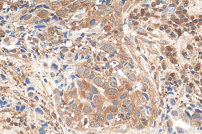 STAT4 Antibody in Immunohistochemistry (Paraffin) (IHC (P))