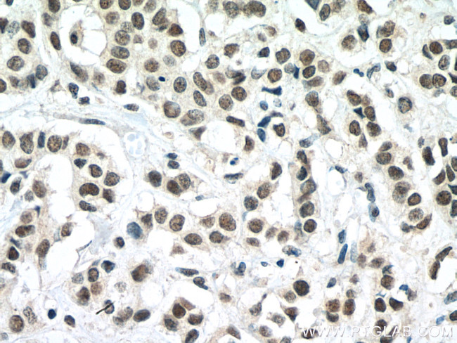 TAF6L Antibody in Immunohistochemistry (Paraffin) (IHC (P))