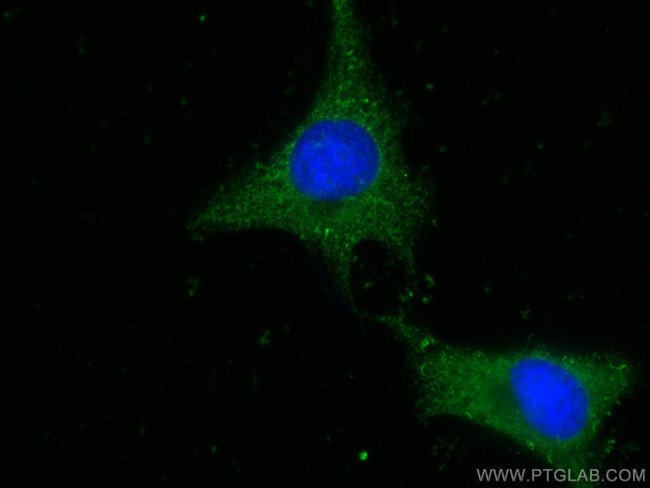 HINT1 Antibody in Immunocytochemistry (ICC/IF)