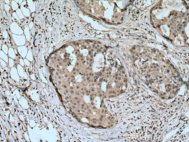 HINT1 Antibody in Immunohistochemistry (Paraffin) (IHC (P))