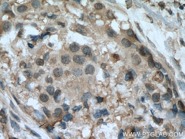 HINT1 Antibody in Immunohistochemistry (Paraffin) (IHC (P))