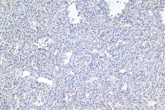 PTP4A1 Antibody in Immunohistochemistry (Paraffin) (IHC (P))