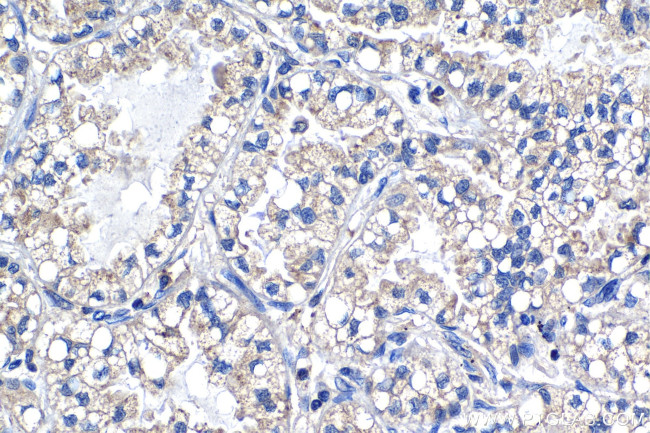 PTP4A1 Antibody in Immunohistochemistry (Paraffin) (IHC (P))