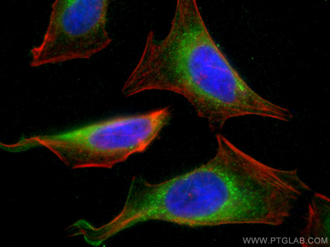 Calumenin Antibody in Immunocytochemistry (ICC/IF)