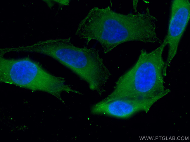 ATM Antibody in Immunocytochemistry (ICC/IF)