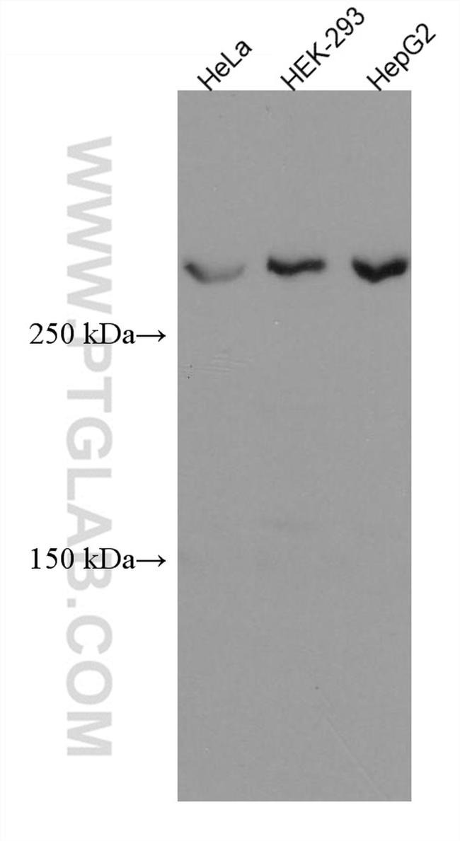 ATM Antibody in Western Blot (WB)