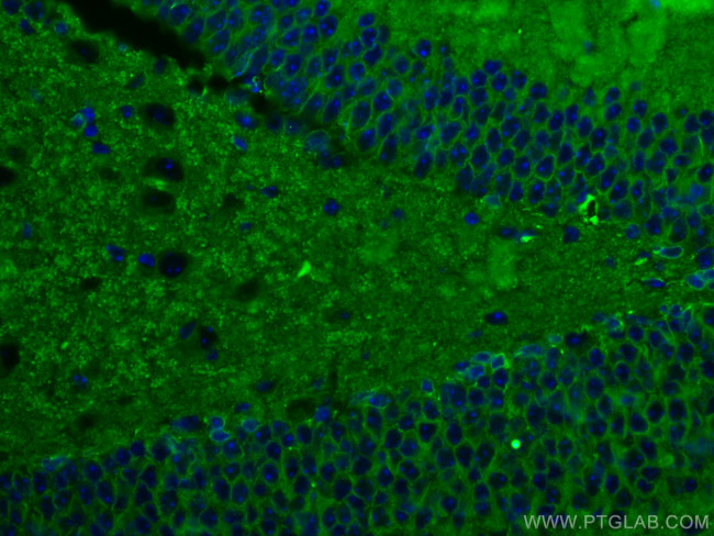 Drebrin Antibody in Immunohistochemistry (Paraffin) (IHC (P))