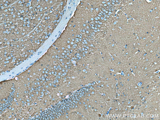 Drebrin Antibody in Immunohistochemistry (Paraffin) (IHC (P))