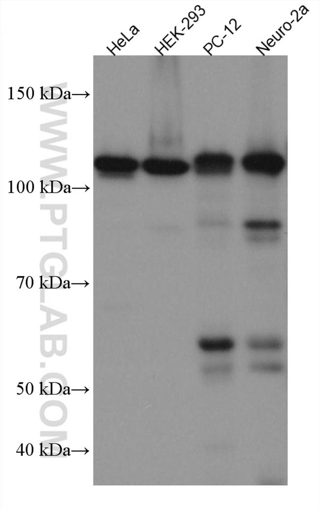 Drebrin Antibody in Western Blot (WB)