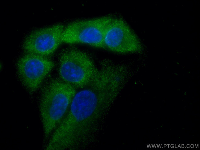 VPS18 Antibody in Immunocytochemistry (ICC/IF)