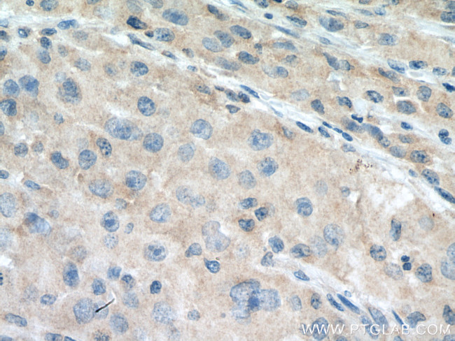 VPS18 Antibody in Immunohistochemistry (Paraffin) (IHC (P))