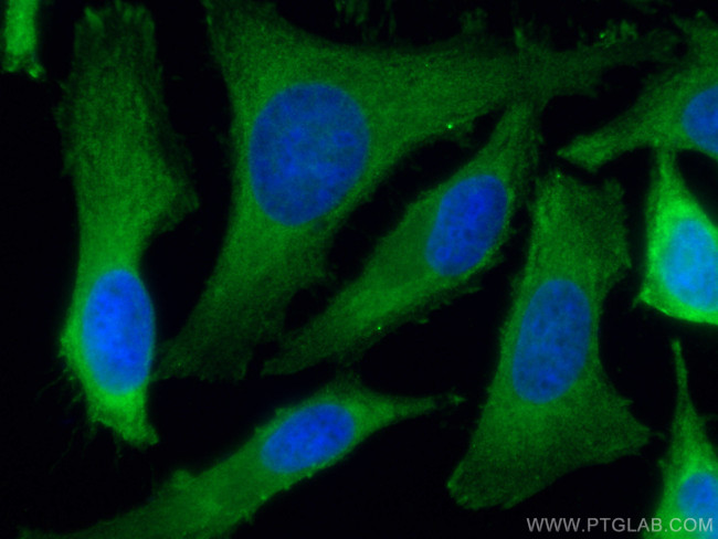 PHGDH Antibody in Immunocytochemistry (ICC/IF)