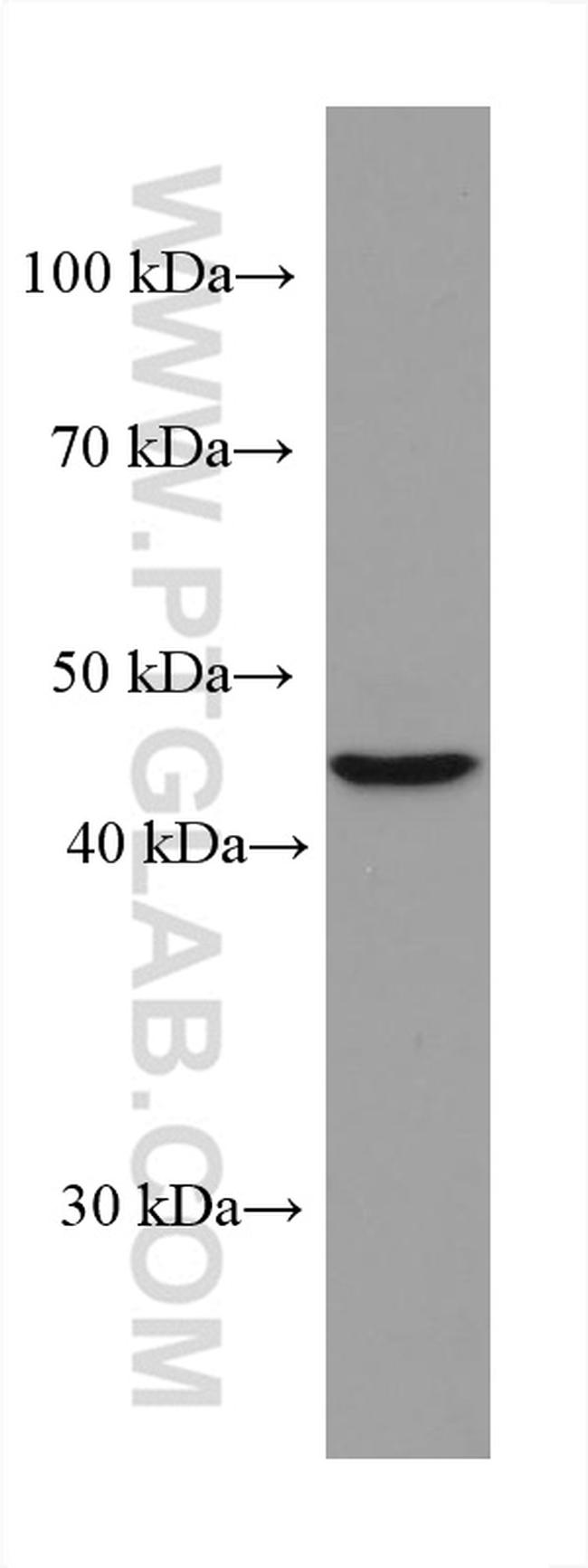 TERF1 Antibody in Western Blot (WB)