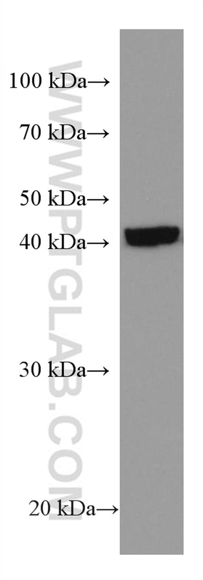 SLC25A37 Antibody in Western Blot (WB)