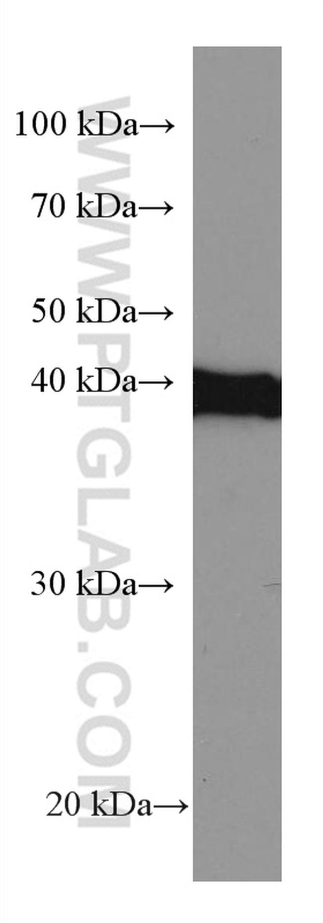 SLC25A37 Antibody in Western Blot (WB)