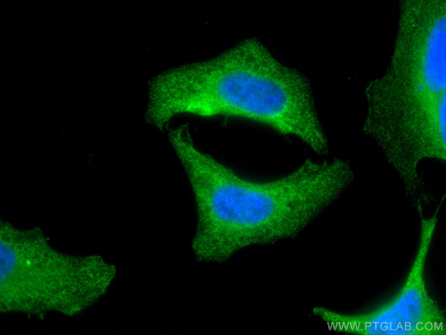 GSS Antibody in Immunocytochemistry (ICC/IF)