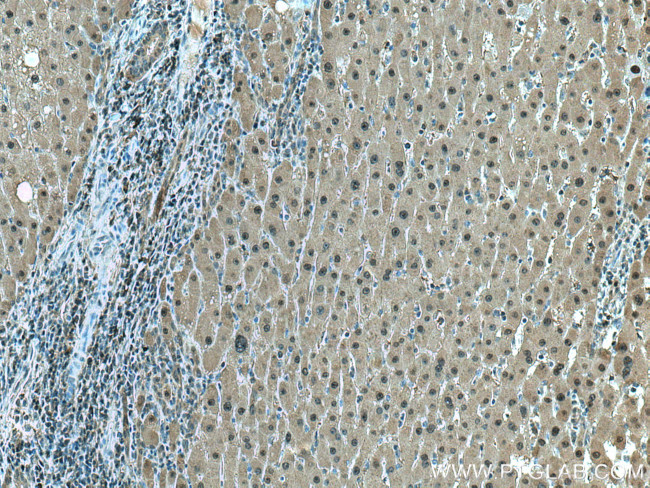 GSS Antibody in Immunohistochemistry (Paraffin) (IHC (P))