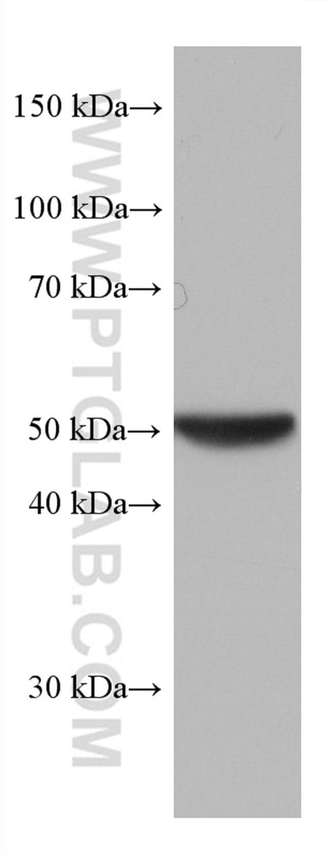 GSS Antibody in Western Blot (WB)